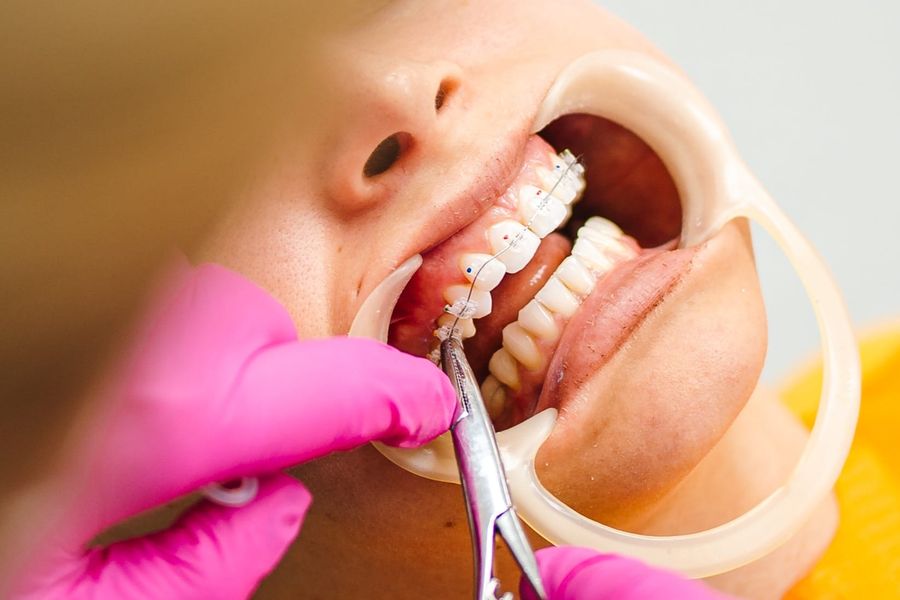 Tratament stomatologic la Ogodent Ploiești